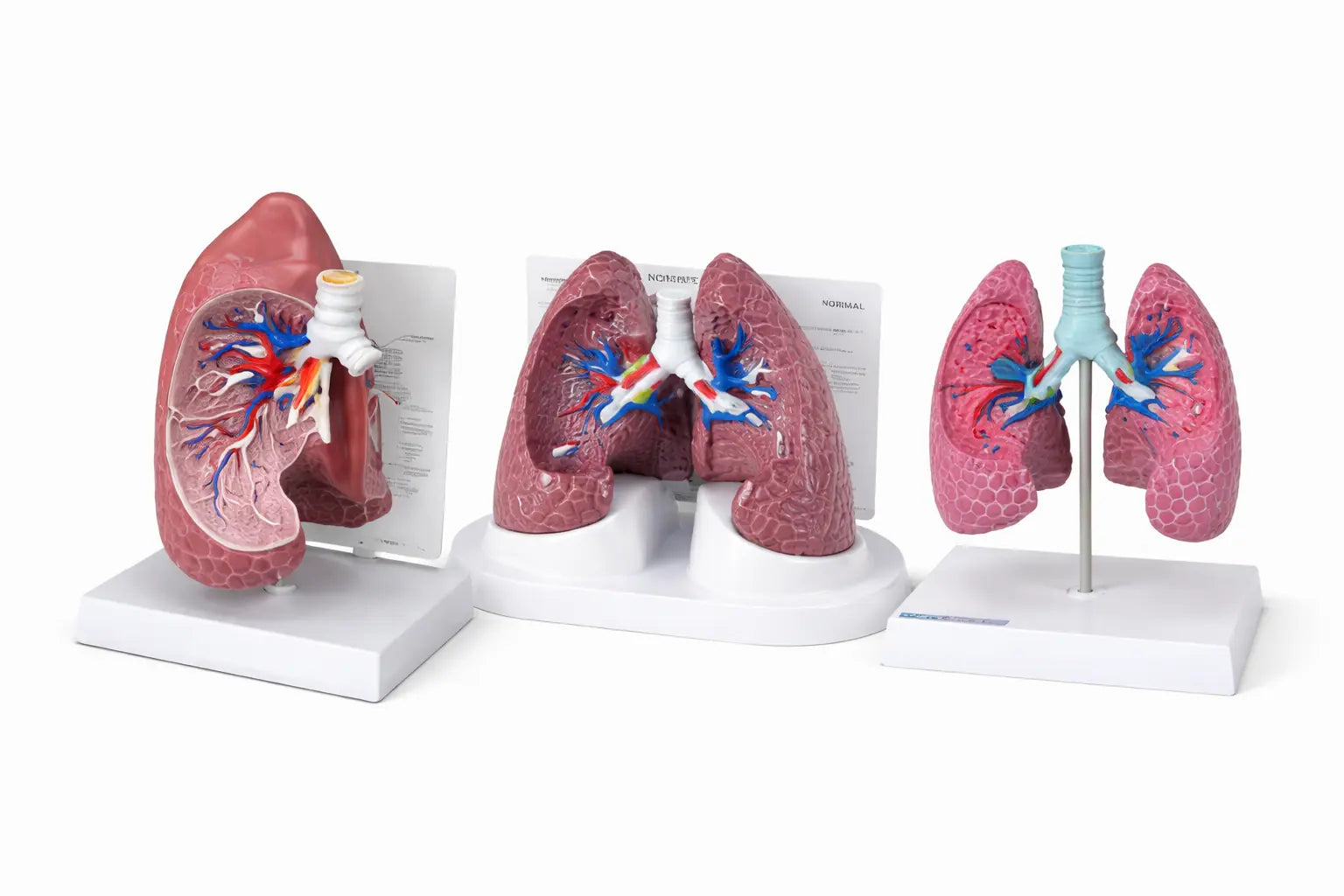 3d lung model