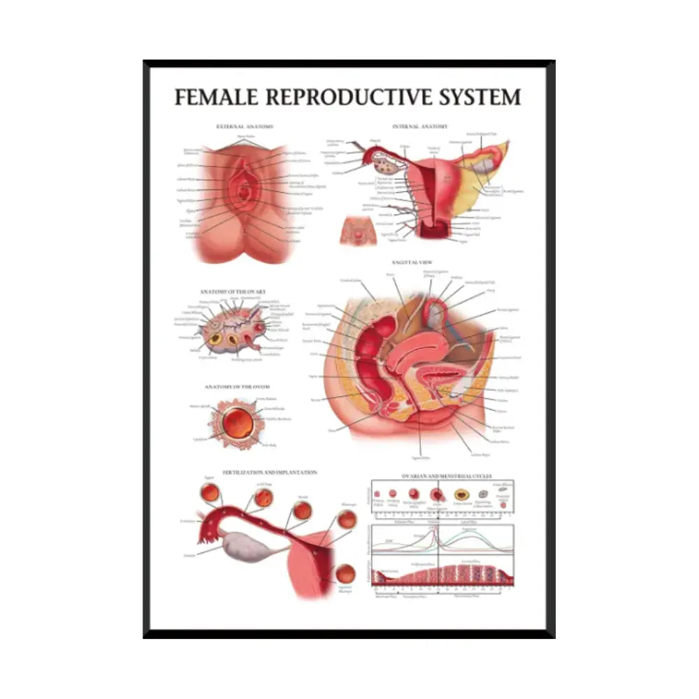 Female Reproductive System Anatomy Medical Poster