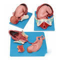 Full-term Fetal Demonstration Birth Model Set (3 Part)
