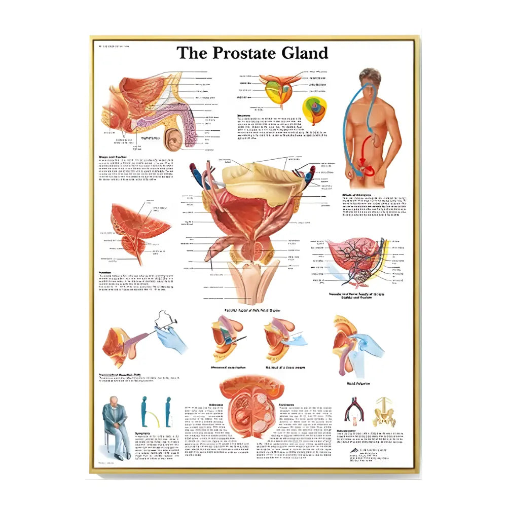 Prostate Gland Anatomy Medical Education Poster