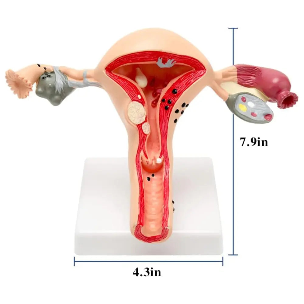 female reproductive system diagram model