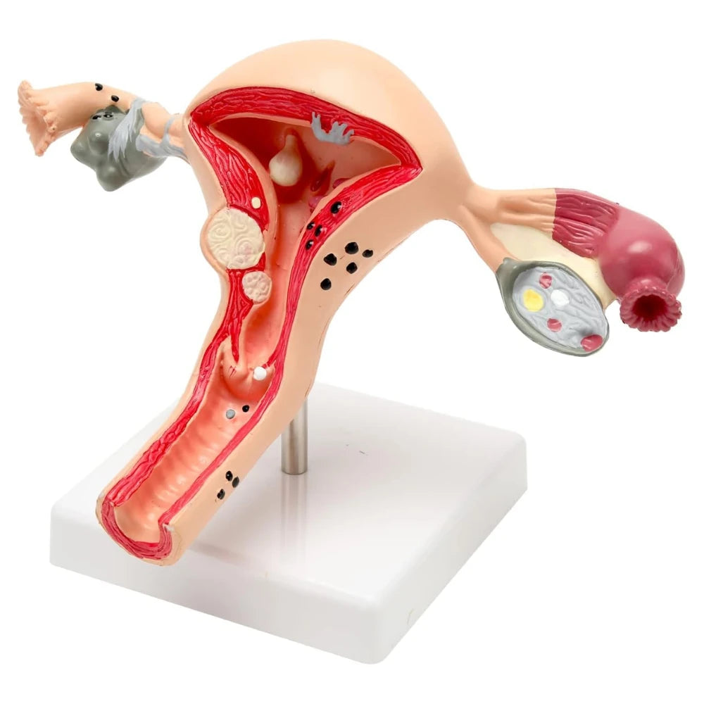Female Reproductive Structure Lab Model Female Reproductive Anatomy Model Set | Human Anatomy Models | Medi ...